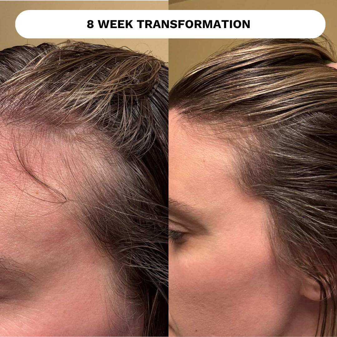 Restore Hydrating Scalp Tonic