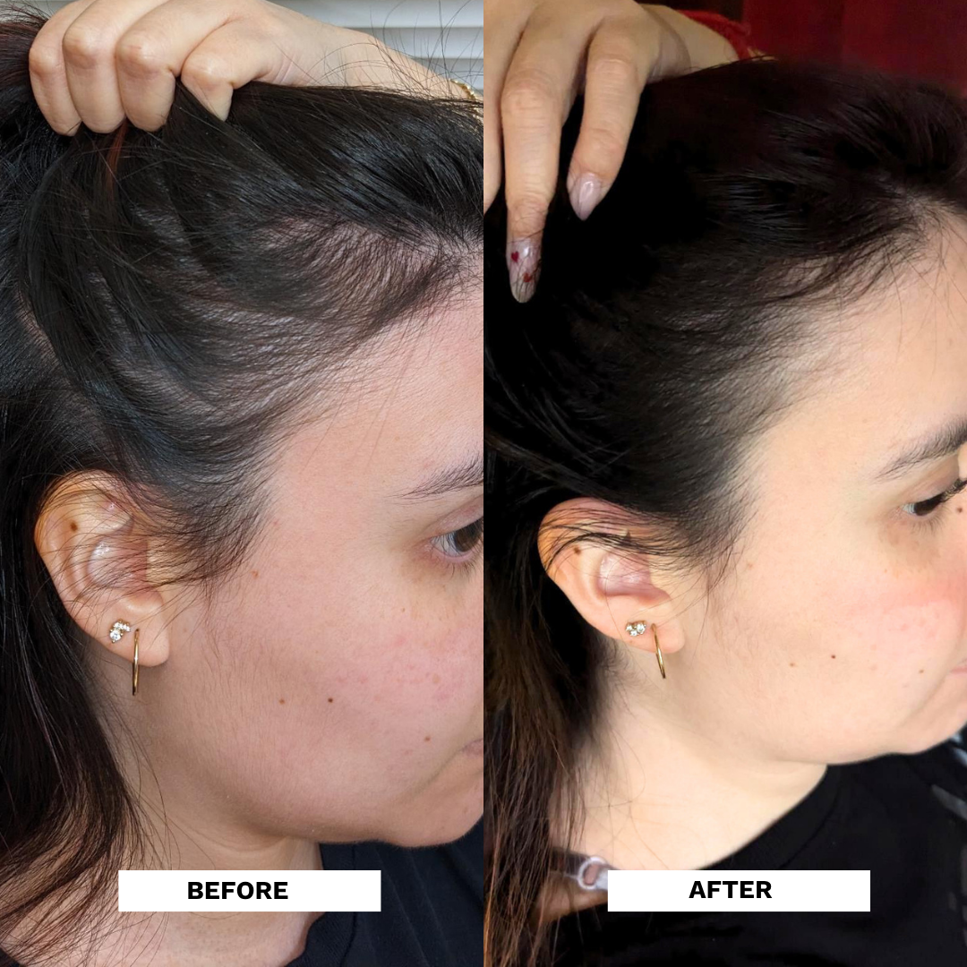 Repair Hair Growth Oil & Scalp Treatment