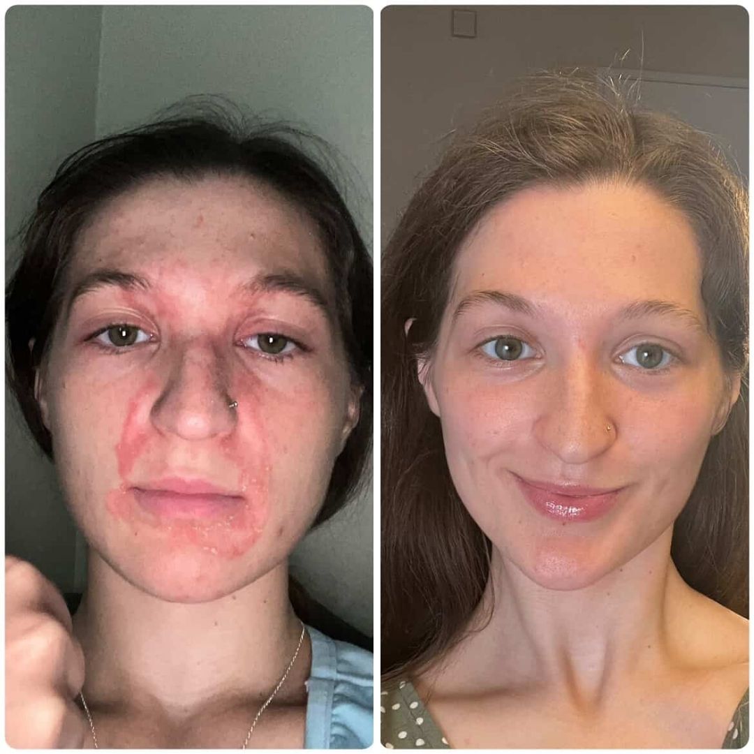 The Golden Bundle: For Dull & Uneven Skin