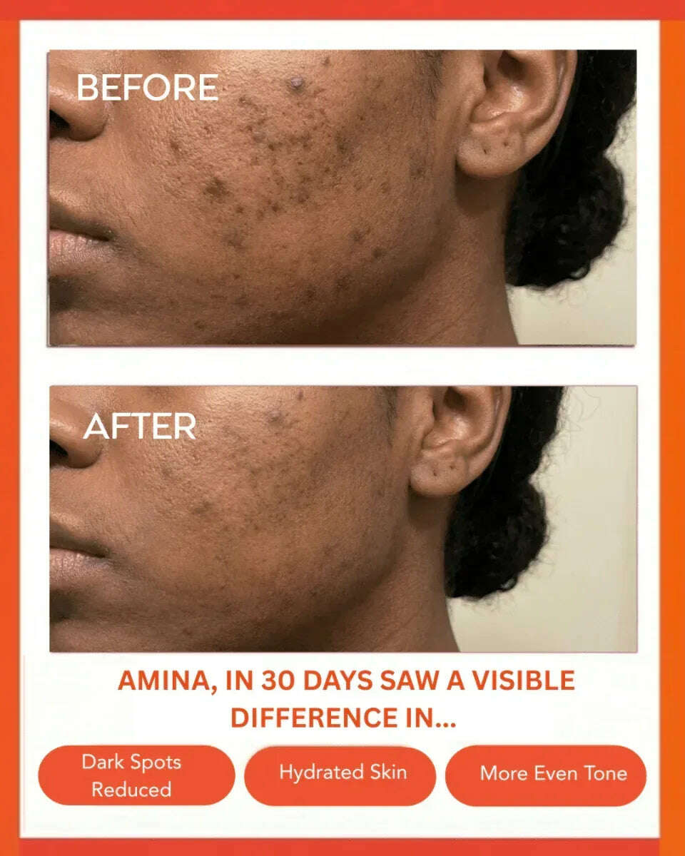 Clear Confidence Moisturizer - Refillable