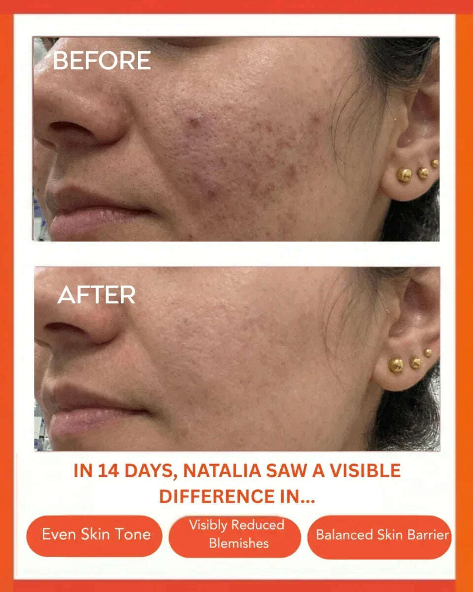 Clear Confidence Moisturizer - Refillable