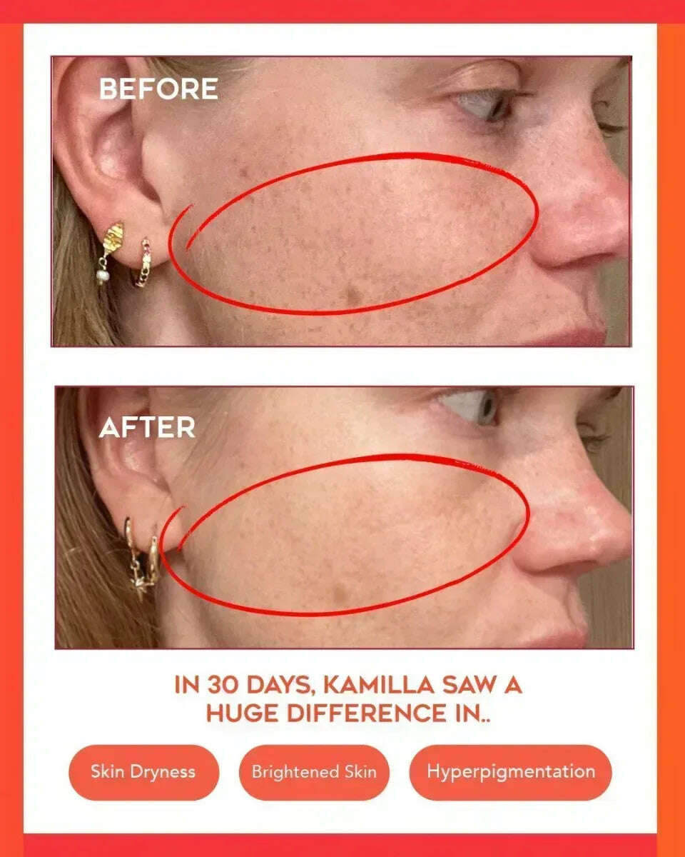 Clear Confidence Moisturizer - Refillable