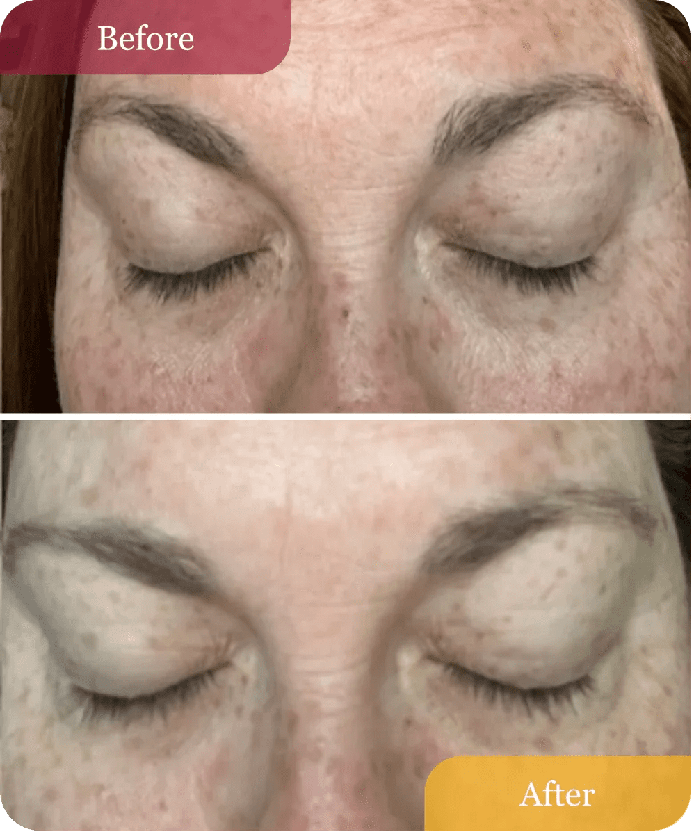 Hydrating Dew Moisturizer - Refillable