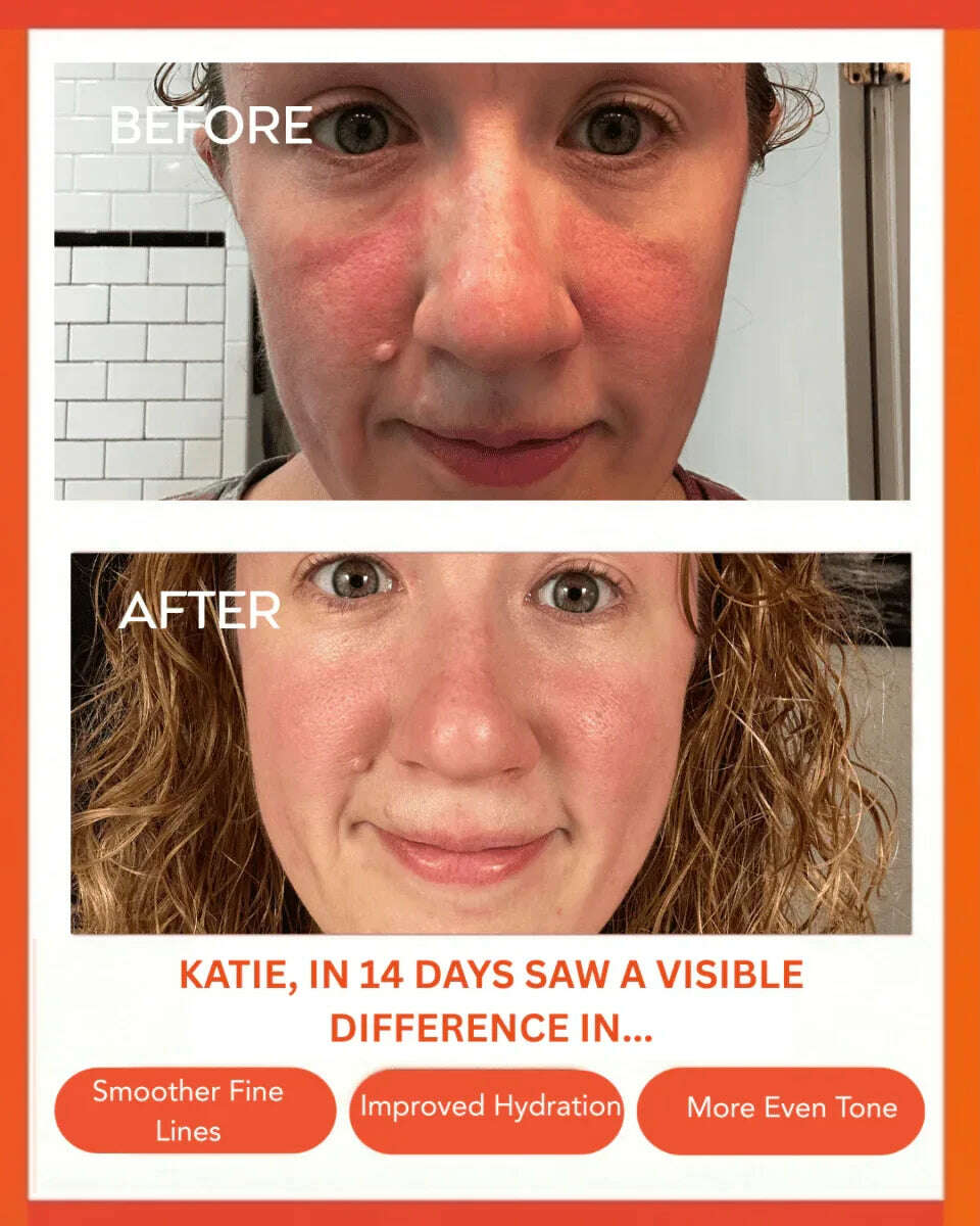 Hydrating Dew Moisturizer - Refillable
