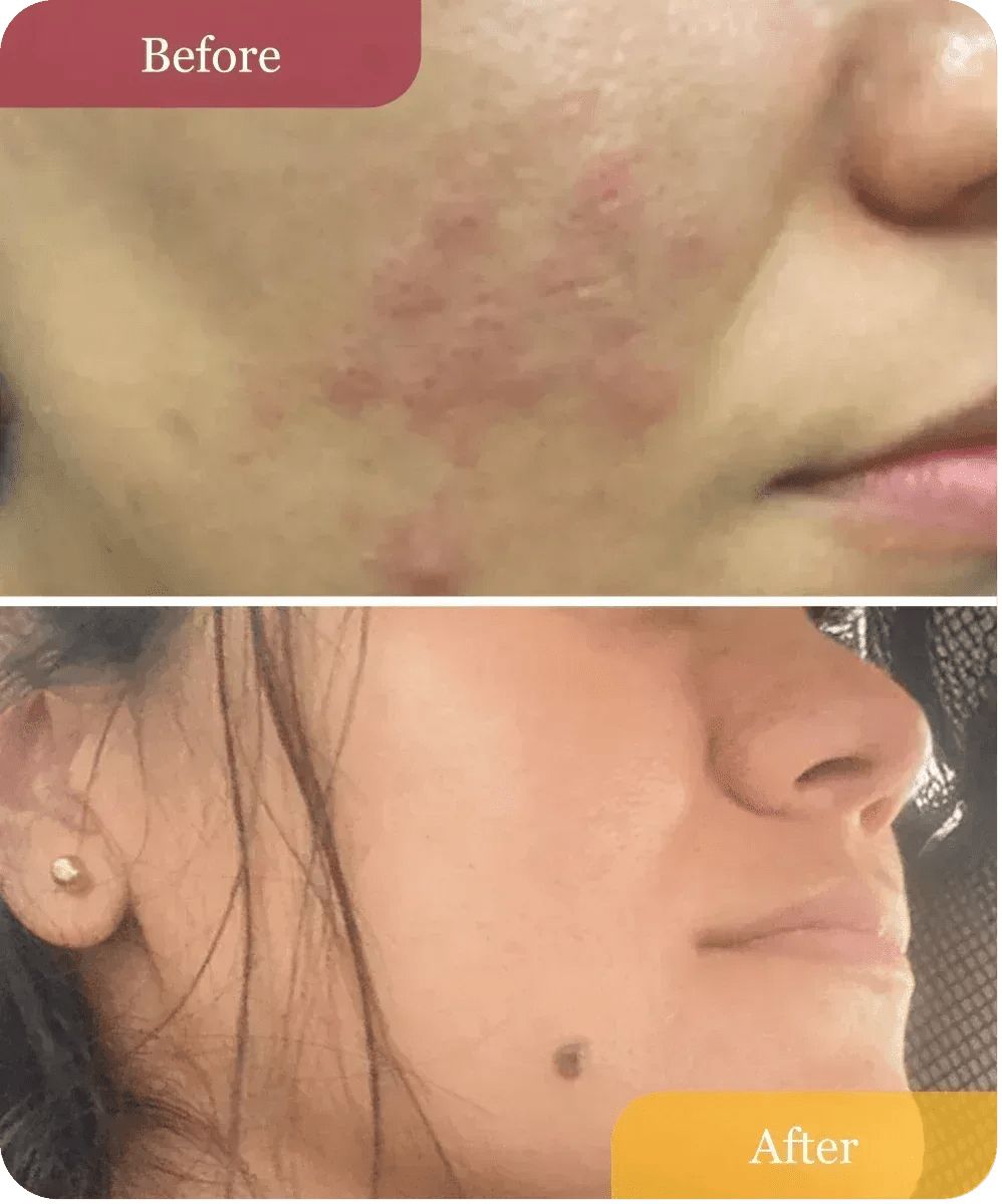 Refillable Clear Confidence Moisturizer
